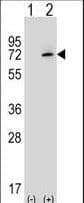 XRCC6 / Ku70 Antibody (aa521-548)