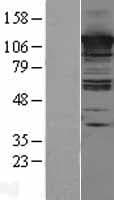 CC2D1A Protein (Over-Expression Lysate Myc-DDK (Flag))