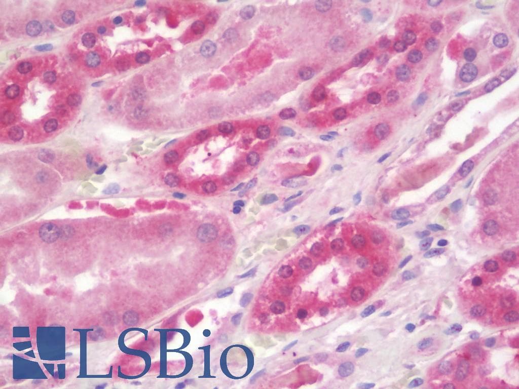IHC-plus™ ATF3 Antibody (aa140-168)