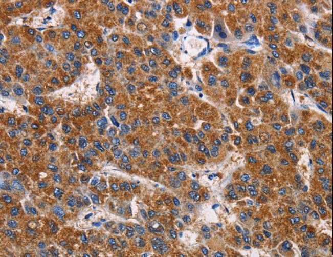 APLNR/ Apelin Receptor / APJ Antibody