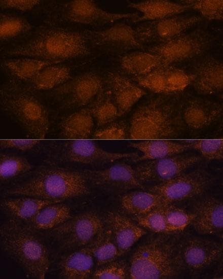 Polyclonal Rabbit anti-Human CEP85 / CCDC21 Antibody (IF)