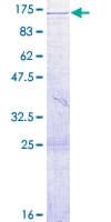 Human VPS39 Protein (Recombinant GST)