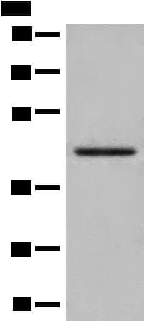DHRS7 Antibody
