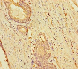 KLHL38 Antibody