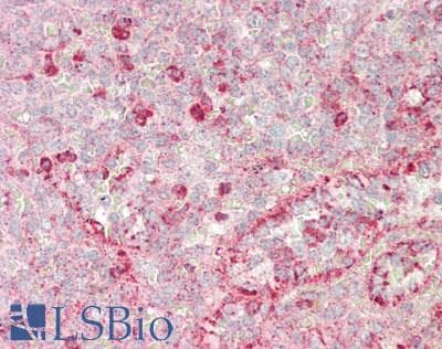 SOD3 Antibody