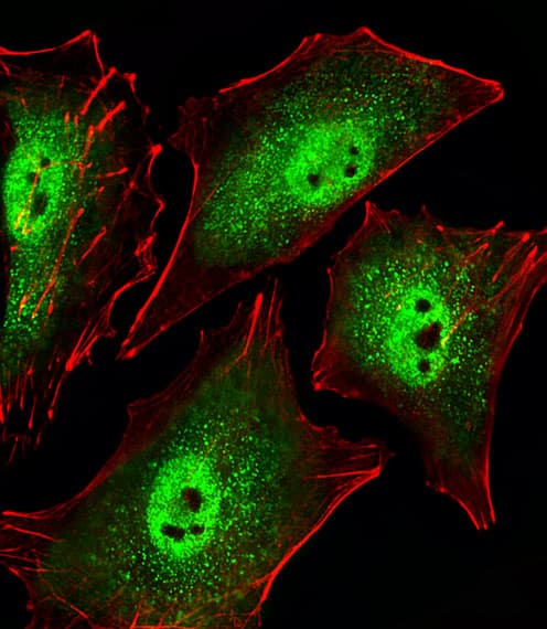 SIRT1 / Sirtuin 1 Antibody (aa566-601)