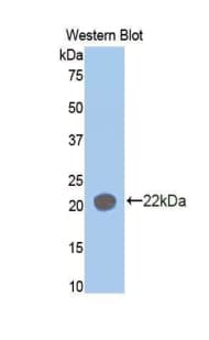 AIMP1 / EMAP II Antibody (aa148-312)
