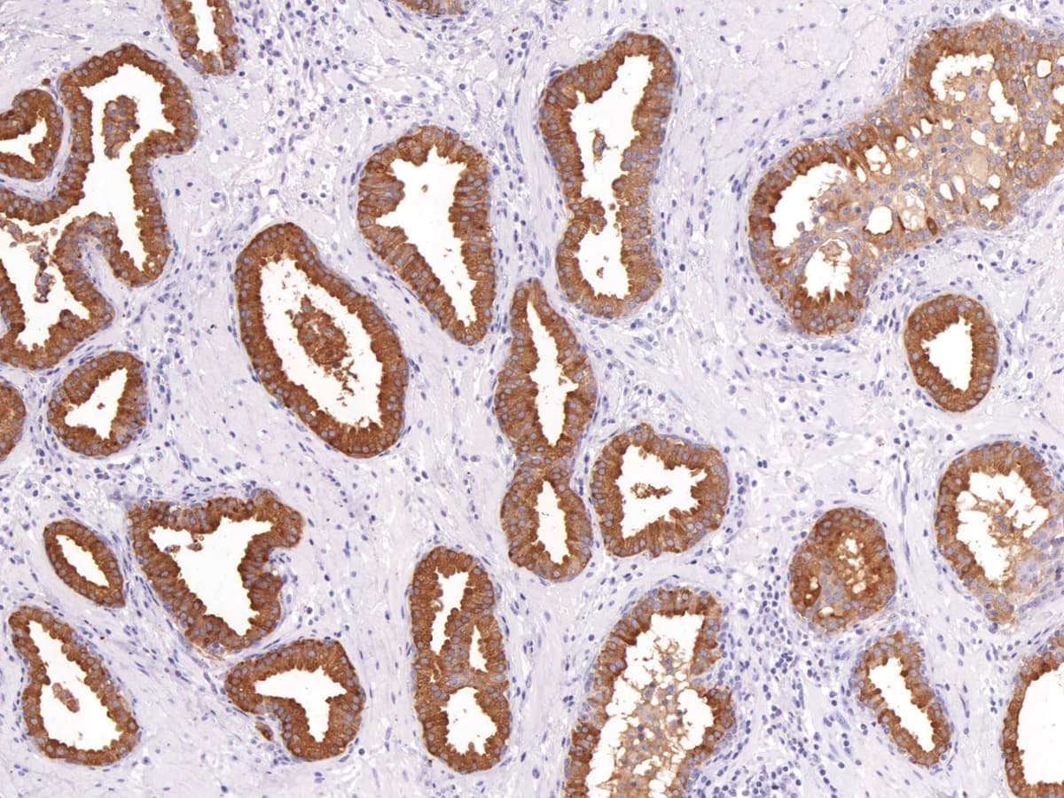 Monoclonal Mouse anti-Human PSA-ACT Complex Antibody (Ready-to-Use, IHC)