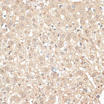 KLHDC3 Antibody