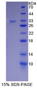 Human CTNNA1 / Catenin Alpha-1 Protein (Recombinant His-T7)