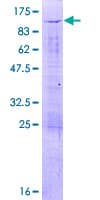 Human UTP3 / CRLZ1 Protein (Recombinant GST)