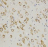 APAF1 / APAF-1 Antibody (N-Terminus)