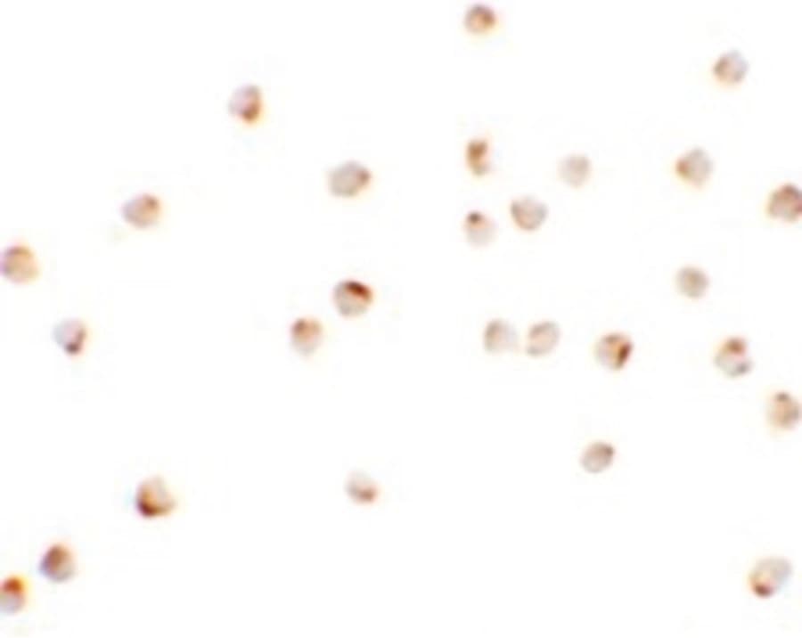 IHC-plus™ Polyclonal Rabbit anti-Human TSHZ1 Antibody (IHC, IF, WB)