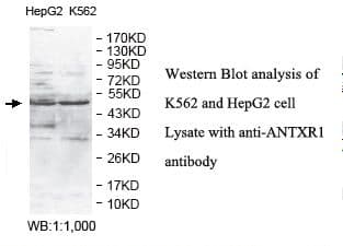 ANTXR1 / TEM8 Antibody (aa19-196)
