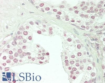 IHC-plus™ TFE3 Antibody