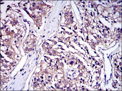 IRAK4 / IRAK-4 Antibody (clone 2H9)