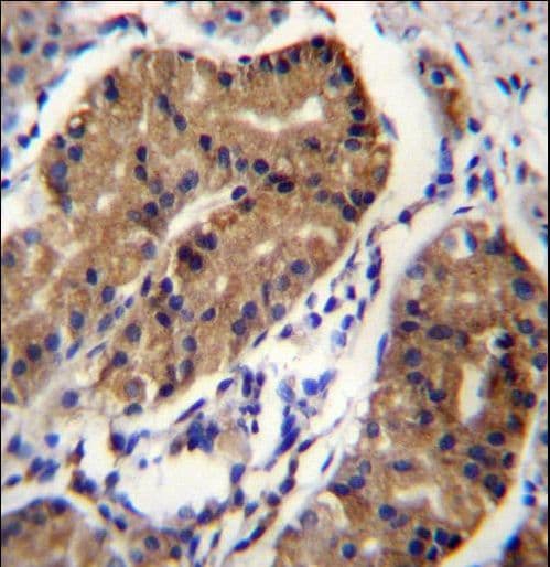 DCC Antibody (aa643-670)