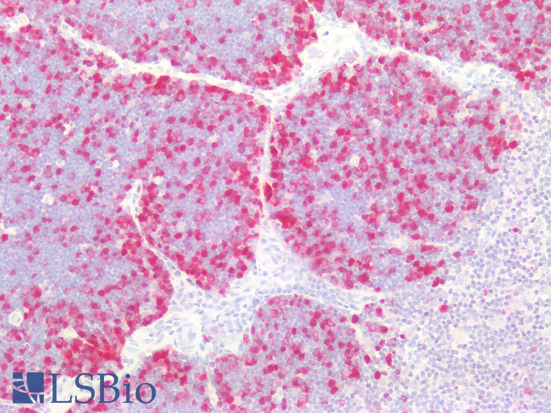 PathPlus™ TS / Thymidylate Synthase Antibody (clone 3F1)