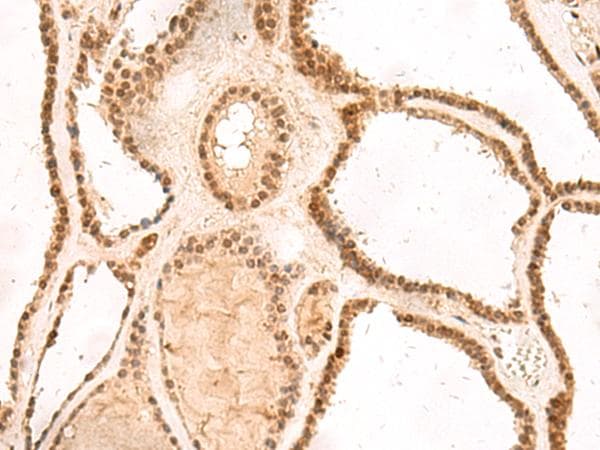 MKX Antibody