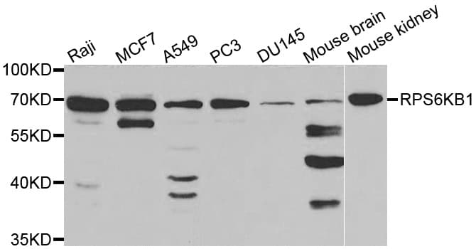 RPS6KB1 / P70S6K / S6K Antibody
