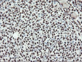 Monoclonal Mouse anti-Human NONO / P54NRB Antibody (clone OTI2E7, IHC, WB)