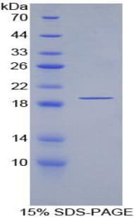 Human PABPC1L Protein (Recombinant His)