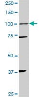 PR / Progesterone Receptor Antibody (clone 3E11)