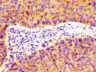 Polyclonal Rabbit anti-Human FLOT1 / Flotillin 1 Antibody (IHC, WB)
