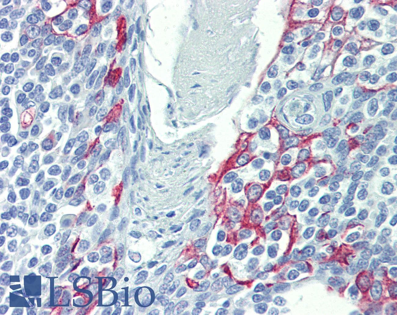LIMD1 Antibody (N-Terminus)
