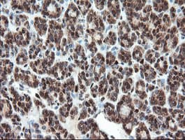 UBE2E3 Antibody (clone OTI6D3)