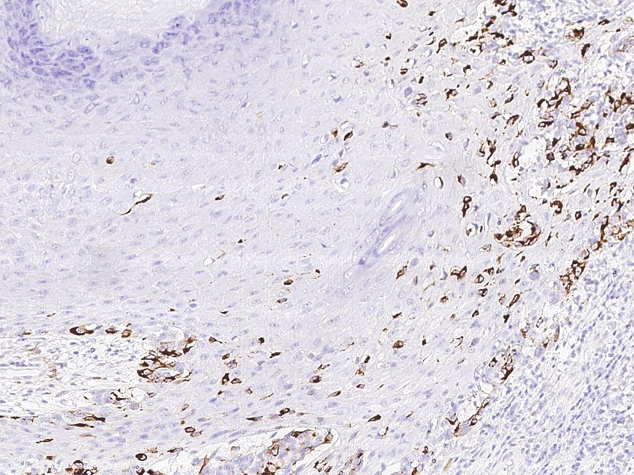RANBP2 / TRP1 Antibody