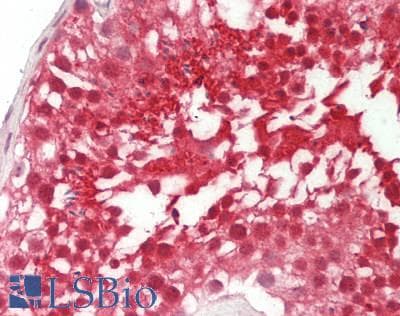 Polyclonal Rabbit anti-Human UCHL3 Antibody (C-Terminus, IHC, WB)