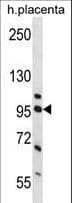 NCL / Nucleolin Antibody (aa276-304)