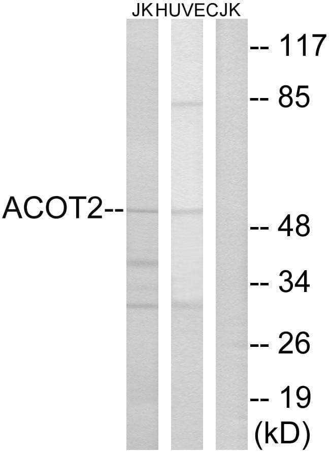 Polyclonal Rabbit anti-Human ACOT2 Antibody (WB)