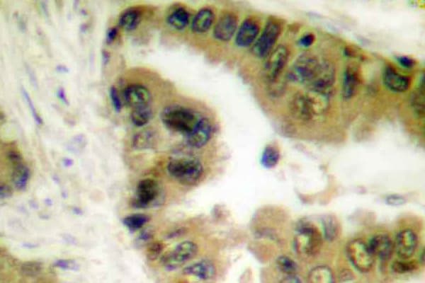 Polyclonal Rabbit anti-Human HDAC10 Antibody (Glu24, IHC, WB)
