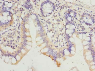 Polyclonal Rabbit anti-Human HDHD3 Antibody (IHC, WB)