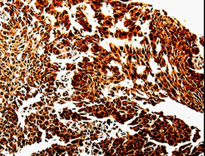 MMP13 Antibody