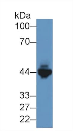 CKM / Creatine Kinase MM Antibody (aa11-367)