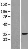 RPLP0 Protein (Over-Expression Lysate Myc-DDK (Flag))