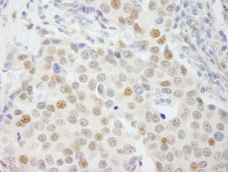 GTF3C4 Antibody (aa625-675)