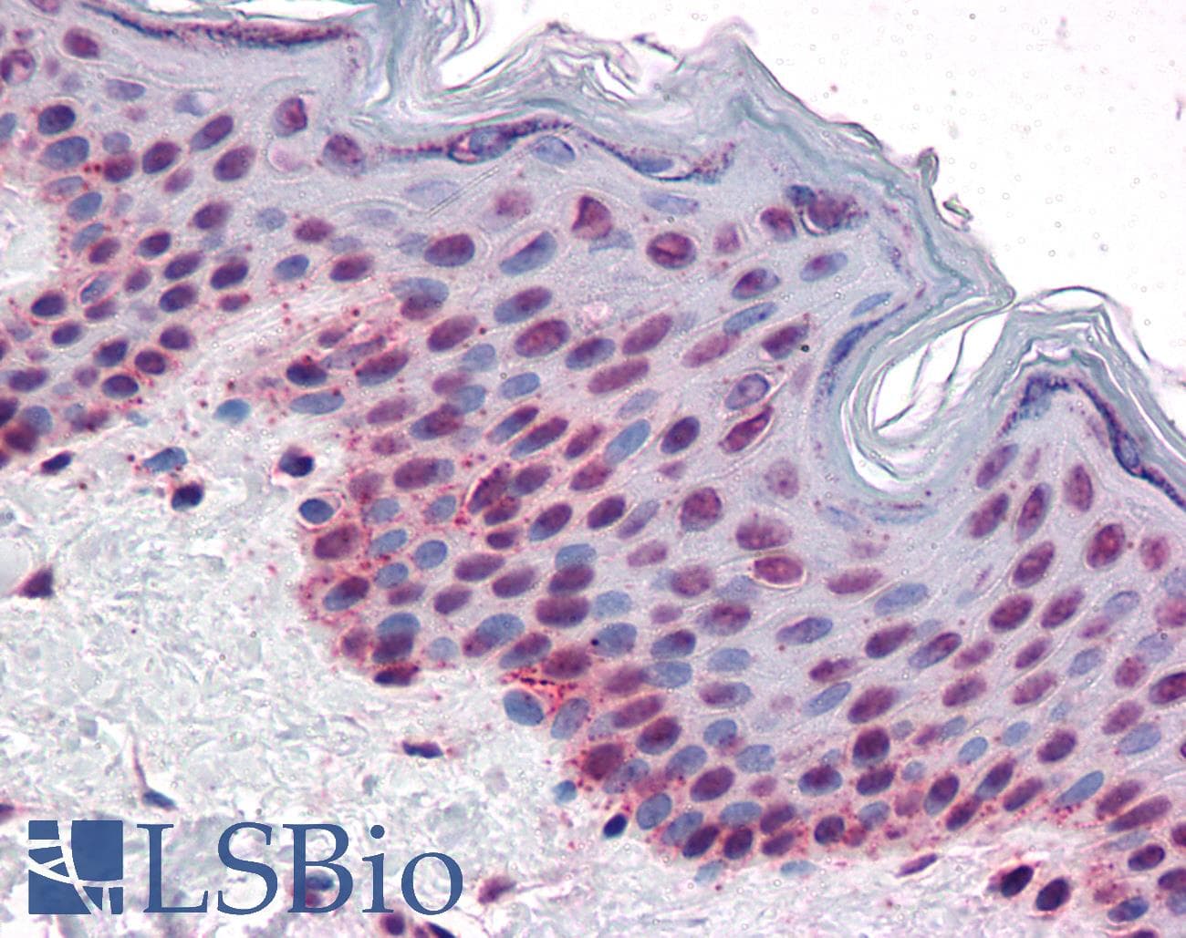 IHC-plus™ Polyclonal Rabbit anti-Human AURKB / Aurora-B Antibody (phospho-Thr232, IHC, WB)