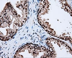 Monoclonal Mouse anti-Human LTA4H / LTA4 Antibody (clone OTI6B5, IHC, WB)