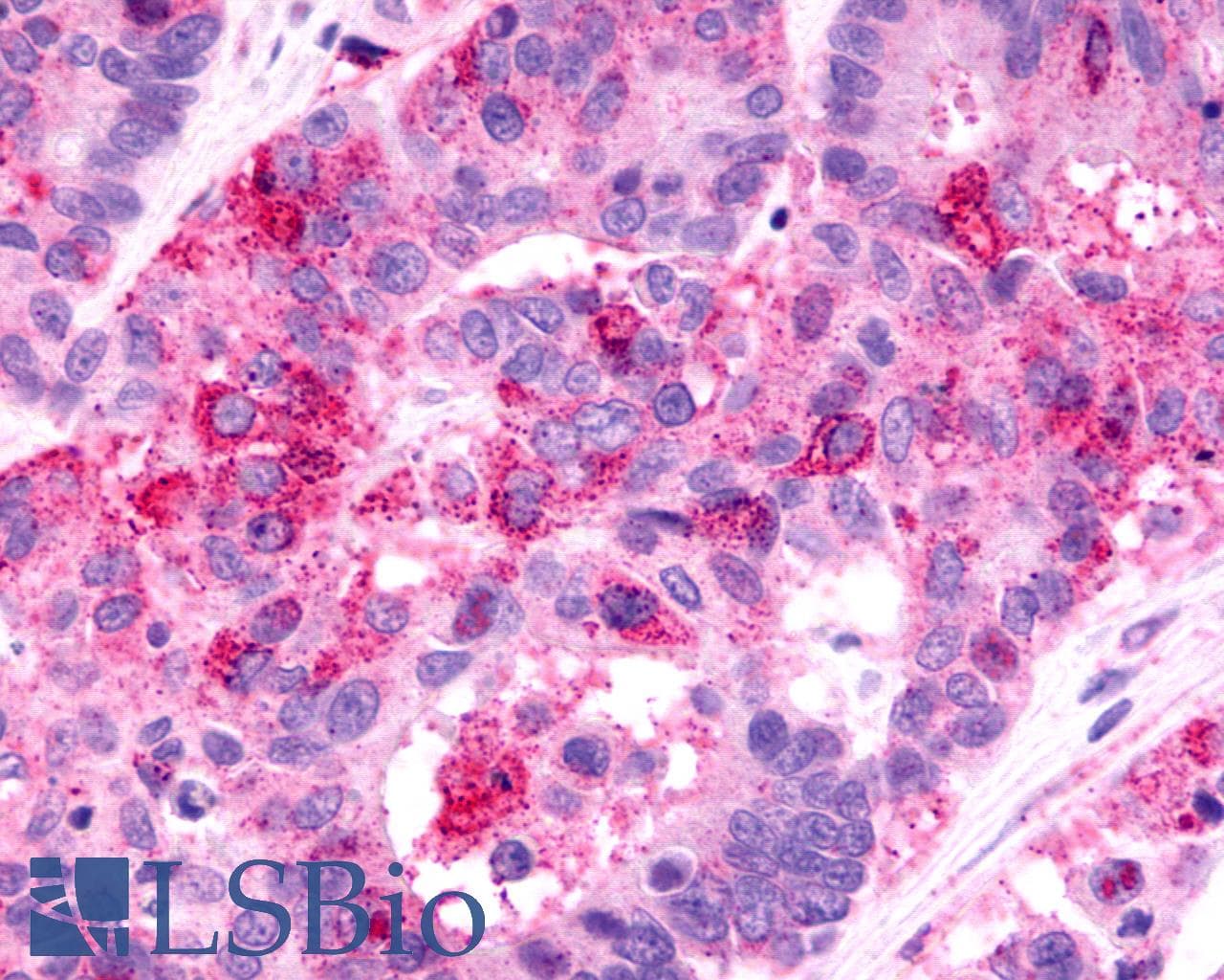 PathPlus™ Polyclonal Rabbit anti-Human FKSG80 / GPR81 Antibody (C-Terminus, IHC)