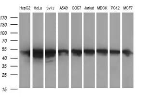 ZSCAN21 / Zipro1 Antibody (clone OTI2F5)