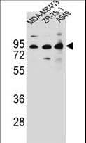 Polyclonal Rabbit anti-Human CTTNBP2NL Antibody (aa135-164, IHC, WB)