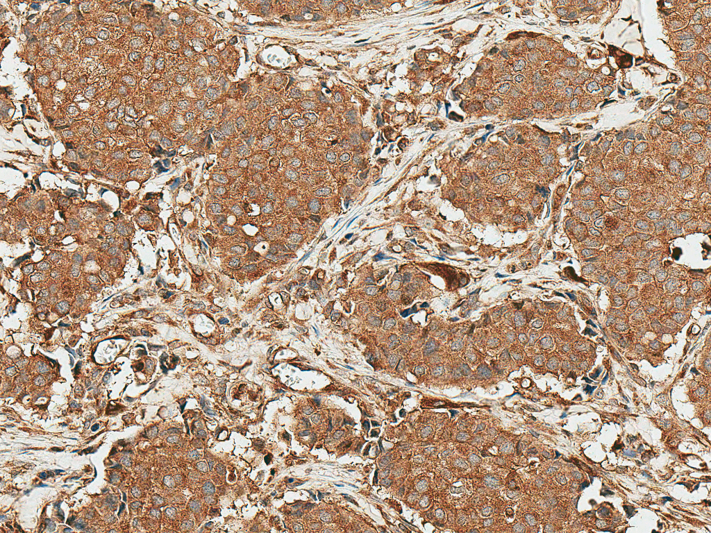 ROR1 Antibody (APC)