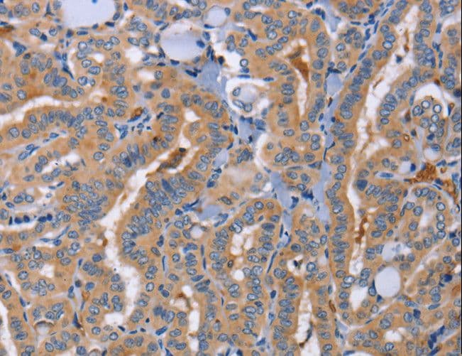 SIGLEC6 Antibody