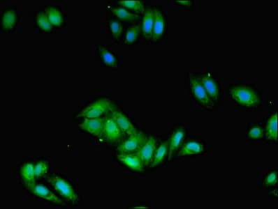 Polyclonal Rabbit anti-Human FCER1G Antibody (WB)