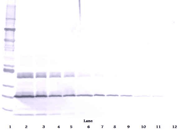 TGFB1 / TGF Beta 1 Antibody