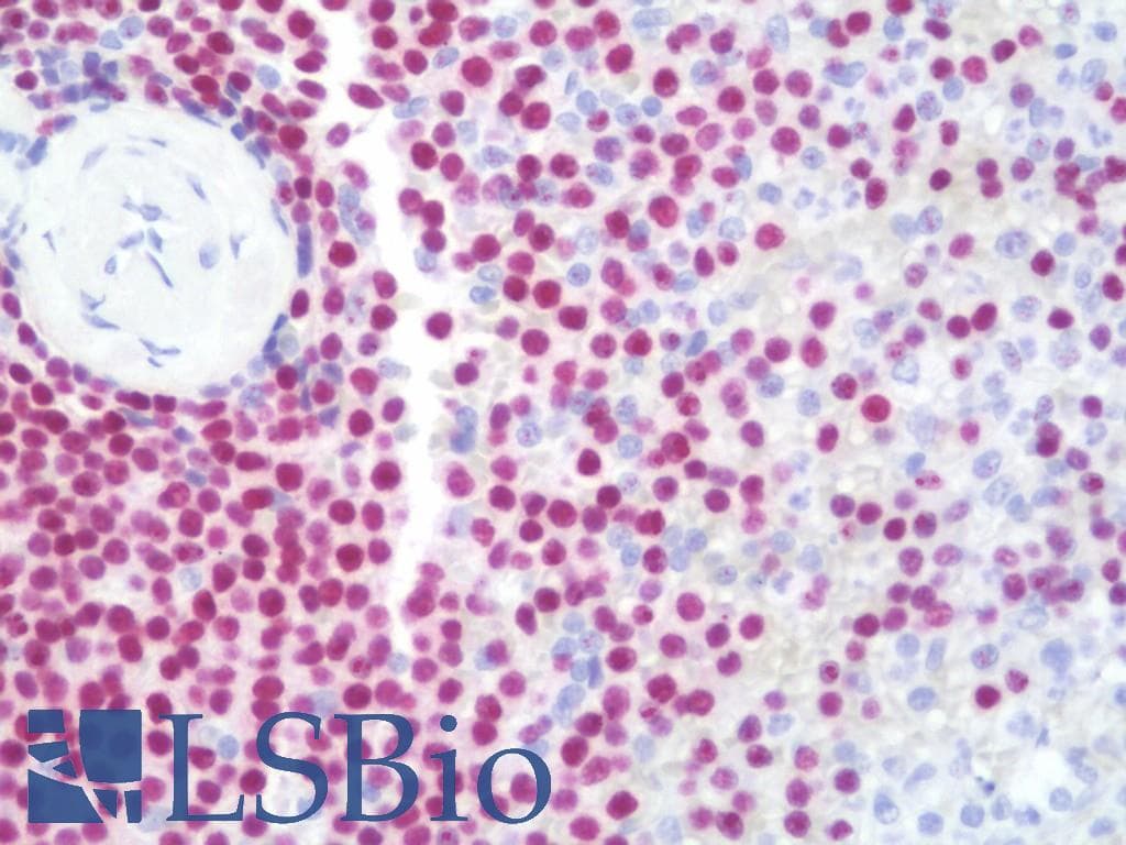 PathPlus™ PAX5 Antibody (clone 1A7)